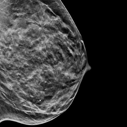 Hologic C-View™ Synthesised 2D Imaging in white background